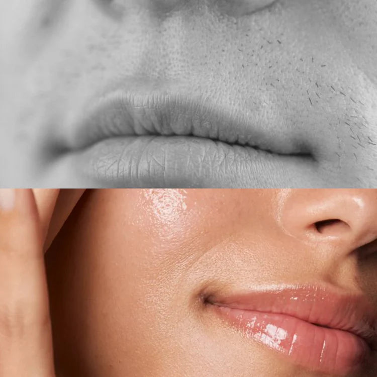 SilkShave - Haarentfernung und Aftershave
