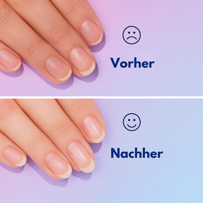 NagelKraft - Regeneration & Schutz für gesunde Nägel