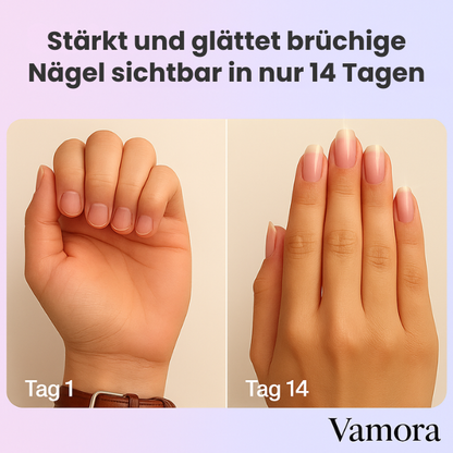 NagelKraft - Regeneration & Schutz für gesunde Nägel