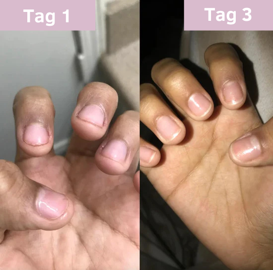 NagelKraft - Regeneration & Schutz für gesunde Nägel